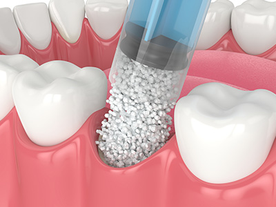 Identical Dental | Cosmetic Dentistry, Oral Cancer Screening and Veneers