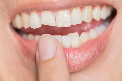 Identical Dental | Oral Cancer Screening, Oral Exams and Dental Bridges