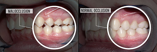 Identical Dental | Veneers, Oral Exams and Night Guards