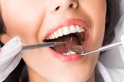 Identical Dental | Fluoride Treatment, Dental Cleanings and Dental Sealants