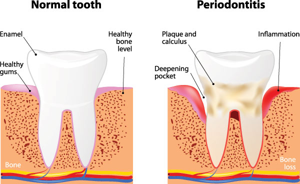 Identical Dental | Pediatric Dentistry, Emergency Treatment and Extractions
