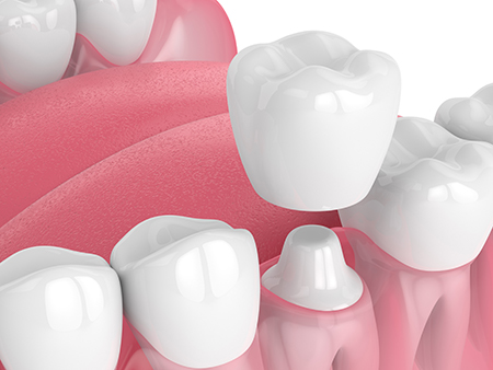 Identical Dental