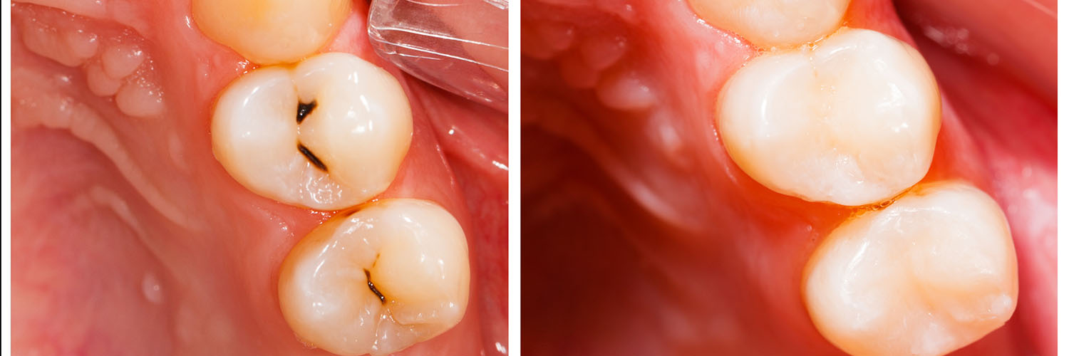 Identical Dental