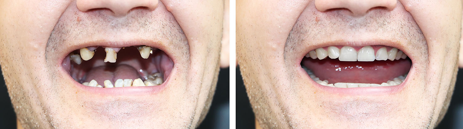 Identical Dental